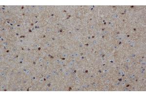 Immunohistochemistry of paraffin-embedded Mouse brain using ENO1 Polyclonal Antibody at dilution of 1:50 (ENO1 antibody)