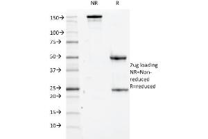 SDS-PAGE Analysis Purified CD84 Mouse Monoclonal Antibody (152-1D5). (CD84 antibody)