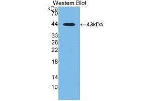 CTBS 抗体  (AA 47-385)