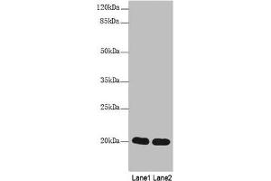 Western Blot All lanes: CABP5 antibody at 12 μg/mL Lane 1: Mouse kidney tissue Lane 2: Mouse thymus tissue Secondary Goat polyclonal to rabbit IgG at 1/10000 dilution Predicted band size: 20 kDa Observed band size: 20 kDa (CABP5 antibody  (AA 1-173))