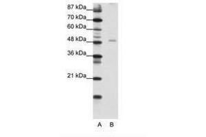 Image no. 1 for anti-Nuclear Factor I/B (NFIB) (AA 187-236) antibody (ABIN202482) (NFIB antibody  (AA 187-236))