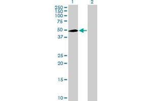 Western Blot analysis of INPP5K expression in transfected 293T cell line by INPP5K MaxPab polyclonal antibody. (INPP5K antibody  (AA 1-448))