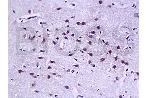 Formalin-fixed and paraffin embedded rat brain tissue labled with Anti-LAMR1(CT) Polyclonal Antibody, Unconjugated (ABIN729598) at 1:200, followed by conjugation to the secondary antibody and DAB staining (LAMR1CT (AA 201-295) antibody)