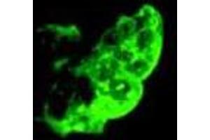 Immunofluorescence staining of methanol-fixed NTERA-2 cl. (TRA1-81 antibody)