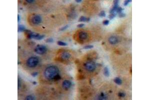 Used in DAB staining on fromalin fixed paraffin-embedded Liver tissue (A1BG antibody  (AA 220-415))