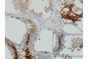 Immunoperoxidase of monoclonal antibody to GAPDHS on formalin-fixed paraffin-embedded human testis.