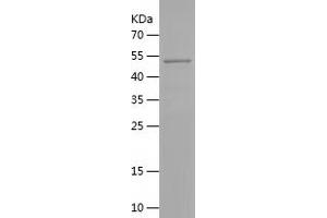 PBX2 Protein (AA 1-256) (His-IF2DI Tag)