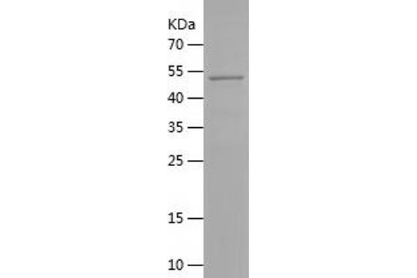 PBX2 Protein (AA 1-256) (His-IF2DI Tag)