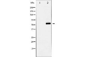 Western blot analysis of YAP phosphorylation expression in COS7 whole cell lysates,The lane on the left is treated with the antigen-specific peptide.