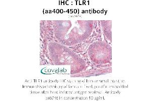 Image no. 1 for anti-Toll-Like Receptor 1 (TLR1) (AA 400-450) antibody (ABIN1740103) (TLR1 antibody  (AA 400-450))