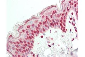 Human Skin: Formalin-Fixed, Paraffin-Embedded (FFPE). (ELF2 antibody  (AA 103-152))