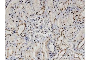Immunoperoxidase of monoclonal antibody to SP140 on formalin-fixed paraffin-embedded human kidney. (SP140 antibody  (AA 504-612))