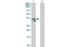 Western Blot analysis of UNG expression in transfected 293T cell line by UNG MaxPab polyclonal antibody. (UNG antibody  (AA 1-304))