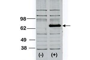 Western blot analysis of BTK polyclonal antibody  transiently transfected HEK293 cell line lysate (1 ug/lane). (BTK antibody  (AA 209-239))