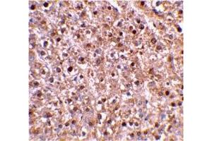 Immunohistochemistry (IHC) image for anti-Caspase 12 (Gene/pseudogene) (CASP12) (Middle Region) antibody (ABIN1030898)
