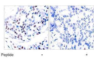 Image no. 1 for anti-Jun Proto-Oncogene (JUN) (Thr239) antibody (ABIN197135) (C-JUN antibody  (Thr239))