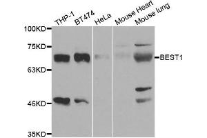 Western blot analysis of extracts of various cell lines, using BEST1 antibody. (Bestrophin 1 antibody)
