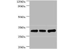 Western blot All lanes: HNRNPA0 antibody at 12 μg/mL Lane 1: Mouse brain tissue Lane 2: Hela whole cell lysate Lane 3: Jurkat whole cell lysate Secondary Goat polyclonal to rabbit IgG at 1/10000 dilution Predicted band size: 31 kDa Observed band size: 31 kDa (HNRNPA (AA 1-180) antibody)