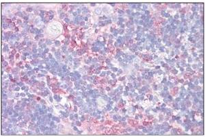 Human Thymus: Formalin-Fixed, Paraffin-Embedded (FFPE) (Galectin 9 antibody  (Internal Region))