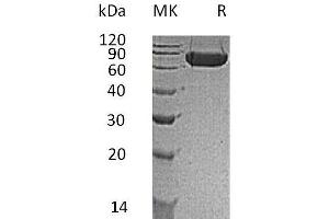 KIRREL Protein (His tag)