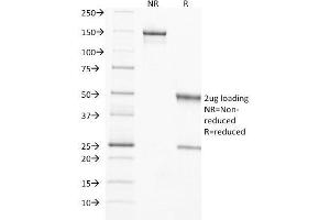SDS-PAGE Analysis Purified TIMP2 Mouse Monoclonal Antibody (3A4). (TIMP2 antibody  (N-Term))