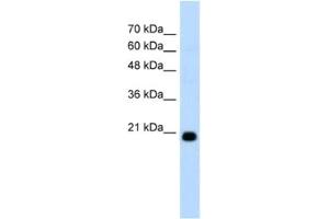Western Blotting (WB) image for anti-F-Box Protein 25 (FBXO25) antibody (ABIN2462666) (FBXO25 antibody)