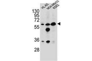 western blot analysis of Glycine amidinotransferase antibody (N-term) in HL-60,MDA-MB453,K562 cell line lysates (35ug/lane).