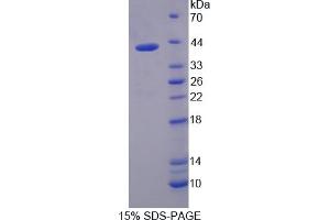 Image no. 1 for Interferon Regulatory Factor 5 (IRF5) (AA 136-475) protein (His tag) (ABIN6236764) (IRF5 Protein (AA 136-475) (His tag))