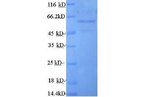 Cytochrome B5 Reductase 3 (CYB5R3) (AA 1-301), (full length) protein (GST tag) (CYB5R3 Protein (AA 1-301, full length) (GST tag))