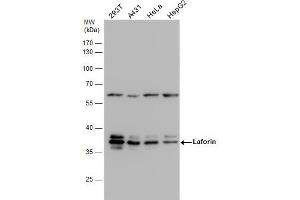 Western Blotting (WB) image for anti-Epilepsy, Progressive Myoclonus Type 2A, Lafora Disease (Laforin) (EPM2A) (C-Term) antibody (ABIN2855883)