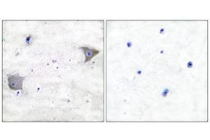 Immunohistochemistry (IHC) image for anti-Platelet Derived Growth Factor Receptor alpha (PDGFRA) (C-Term) antibody (ABIN1848739) (PDGFRA antibody  (C-Term))