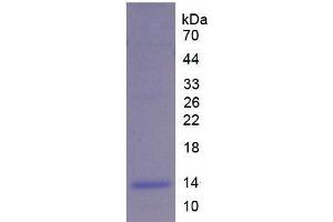 SDS-PAGE analysis of Rat UCP2 Protein. (UCP2 Protein)