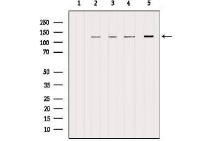 Western blot analysis of extracts from various samples, using NCKAP1 Antibody. (NCKAP1 antibody  (Internal Region))