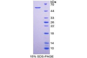 SDS-PAGE (SDS) image for CD320 Molecule (CD320) (AA 36-256) protein (His tag,GST tag) (ABIN2122640)