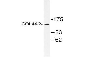 Western blot (WB) analysis of COL4A2 antibody in extracts from Jurkat cells. (COL4a2 antibody  (Chain alpha 2))
