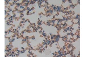 Detection of TM in Mouse Lung Tissue using Polyclonal Antibody to Thrombomodulin (TM) (Thrombomodulin antibody  (AA 31-167))