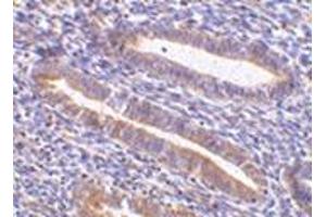 Immunohistochemistry of TIM-1 in human uterus tissue with this product at 10 μg/ml. (HAVCR1 antibody  (N-Term))