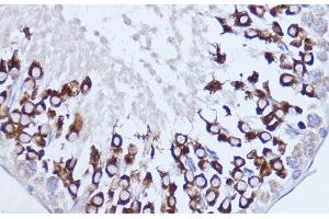 Immunohistochemistry of paraffin-embedded Rat testis using Polyclonal AntibodyPC1 Polyclonal Antibody at dilution of 1:100 (40x lens). (PC1 antibody)