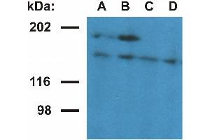 Western blotting analysis of ubinuclein in nuclear fraction of HeLa cells. (Ubinuclein 1 antibody  (AA 1-190))