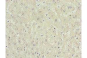 Immunohistochemistry of paraffin-embedded human liver tissue using ABIN7161567 at dilution of 1:100 (NNMT antibody  (AA 1-264))