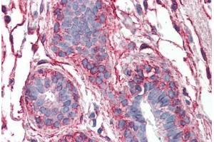 Human Breast: Formalin-Fixed, Paraffin-Embedded (FFPE) (PAK1 antibody  (AA 191-280))