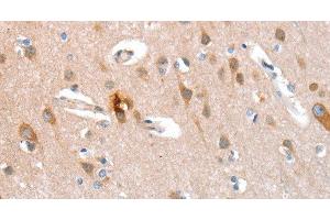 Immunohistochemistry of paraffin-embedded Human brain tissue using CD238 Polyclonal Antibody at dilution 1:40 (KEL antibody)