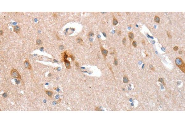 KEL antibody