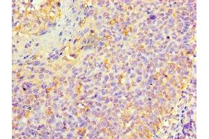 Immunohistochemistry of paraffin-embedded human tonsil tissue using ABIN7157433 at dilution of 1:100 (KRT6A antibody  (AA 2-564))