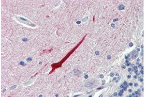 Brain, cerebellum, Human: Formalin-Fixed, Paraffin-Embedded (FFPE) (Septin 11 antibody  (N-Term))