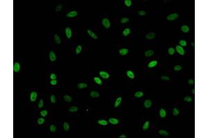 Immunofluorescent analysis of Hela cells (sodium butyrate, 30 mM, 4h) using ABIN7139190 at dilution of 1:100 and Alexa Fluor 488-congugated AffiniPure Goat Anti-Rabbit IgG(H+L) (HIST1H1C antibody  (acLys62))
