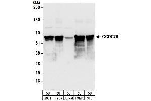 Western Blotting (WB) image for anti-Coiled-Coil Domain Containing 76 (CCDC76) (AA 25-75) antibody (ABIN7453053)