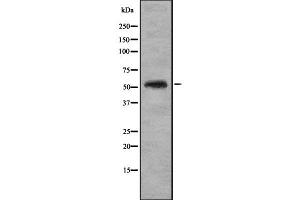 Western blot analysis of KR1_HHV11 using K562 whole cell lysates (KR1_HHV11 antibody)