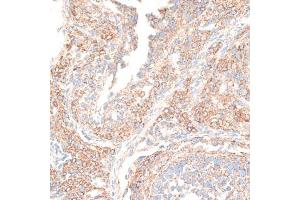 Immunohistochemistry of paraffin-embedded rat ovary using KIF14 antibody (ABIN6129691, ABIN6142854, ABIN6142855 and ABIN6214465) at dilution of 1:100 (40x lens). (KIF14 antibody  (AA 1399-1648))