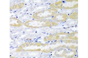 Immunohistochemistry of paraffin-embedded Mouse kidney using FABP6 Polyclonal Antibody at dilution of 1:200 (40x lens).